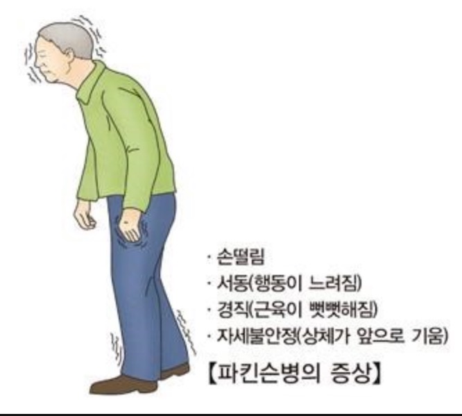 수전증이란? 수전증의 원인 및 2