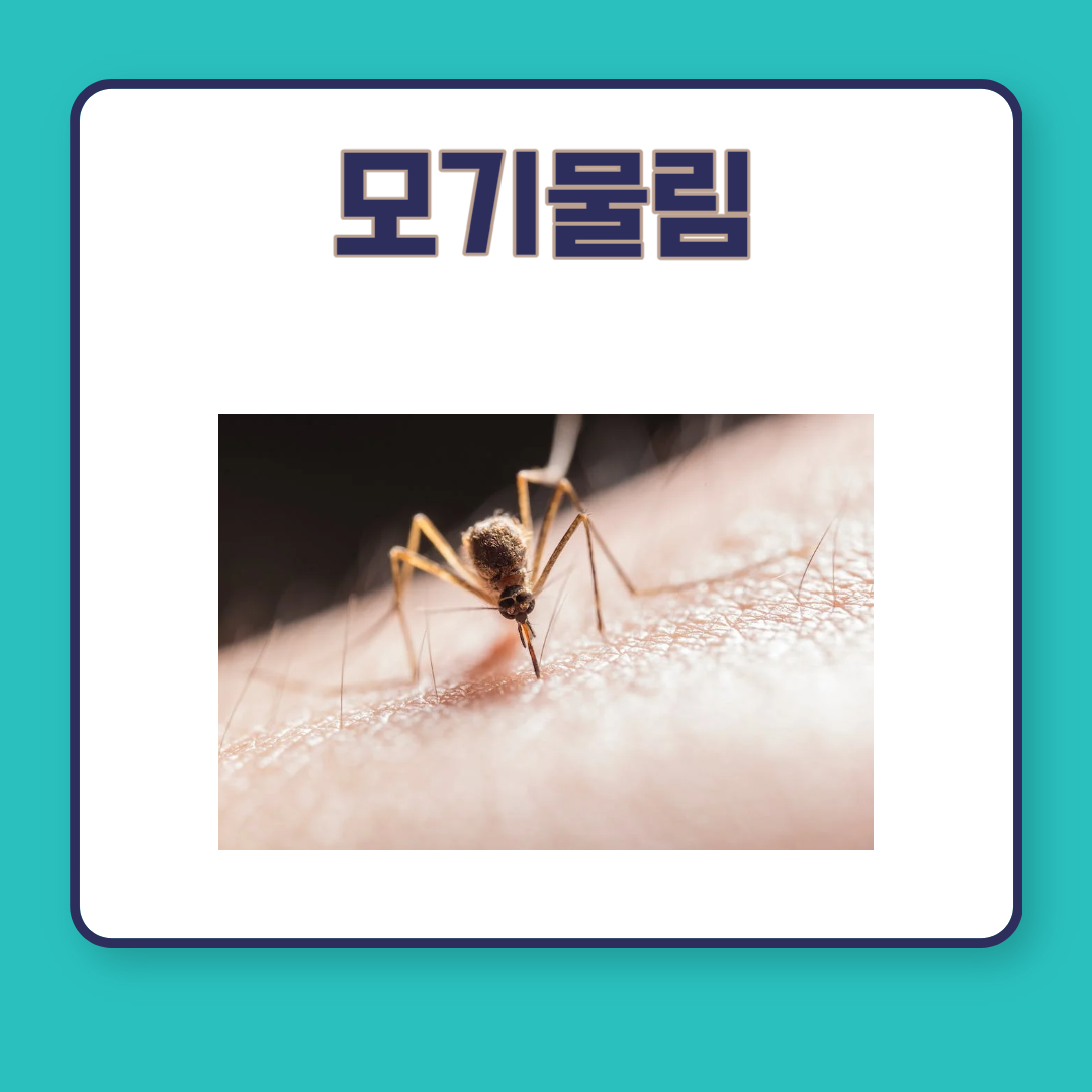 여름철 벌레에 물렸을때 지네물림 모기물림 대처법 치료법 알아보기