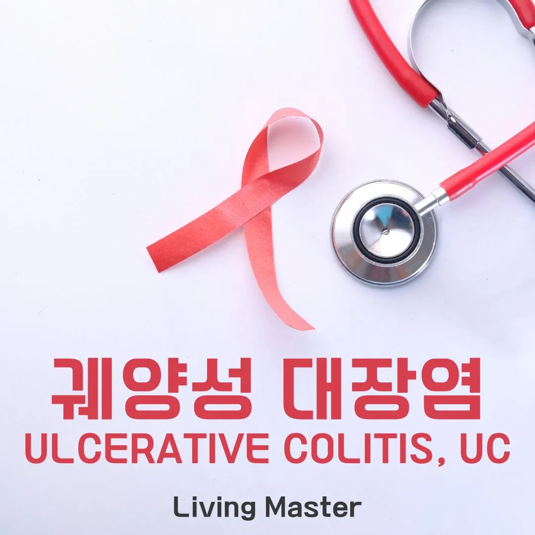궤양성 대장염(Ulcerative Colitis, UC)