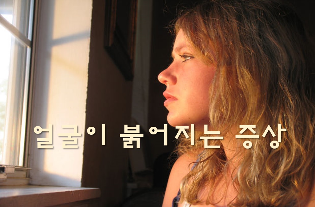  얼굴이 붉어지는 증상과 화끈거리는 증상