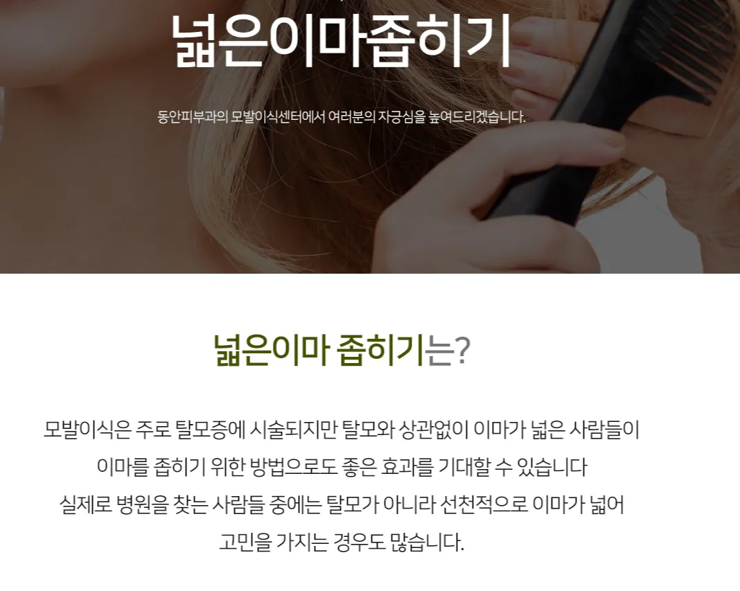 넓은이마