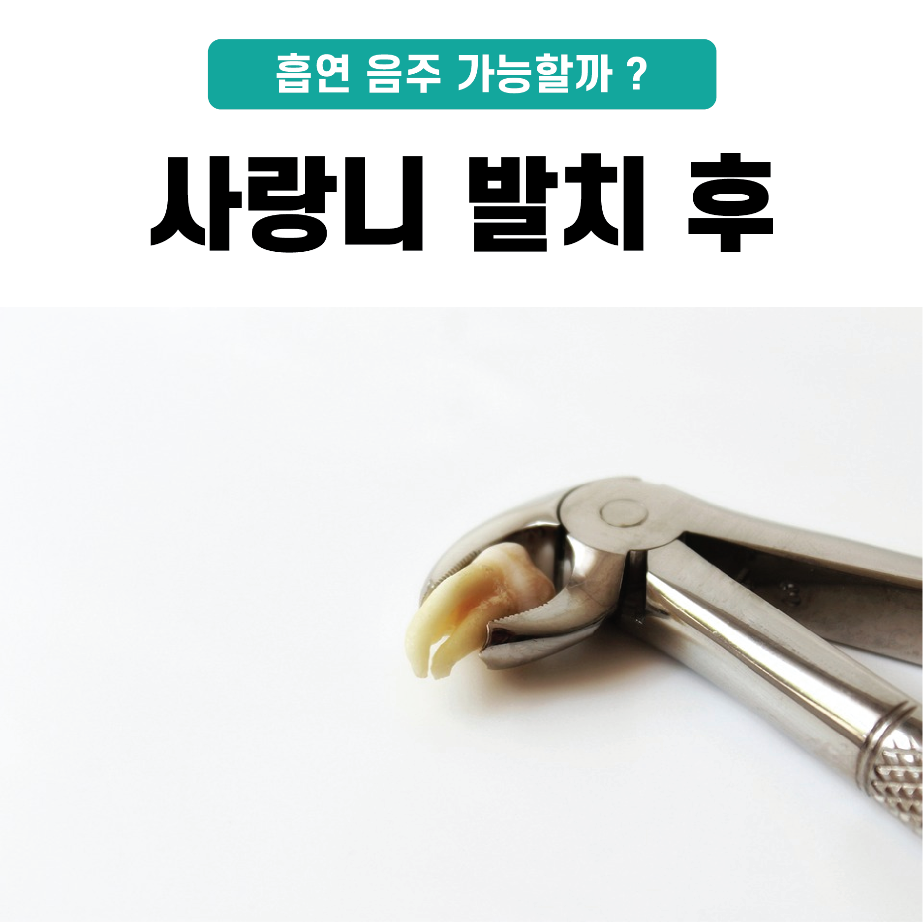 사랑니 발치 후 흡연/음주 당일 가능할까? 8