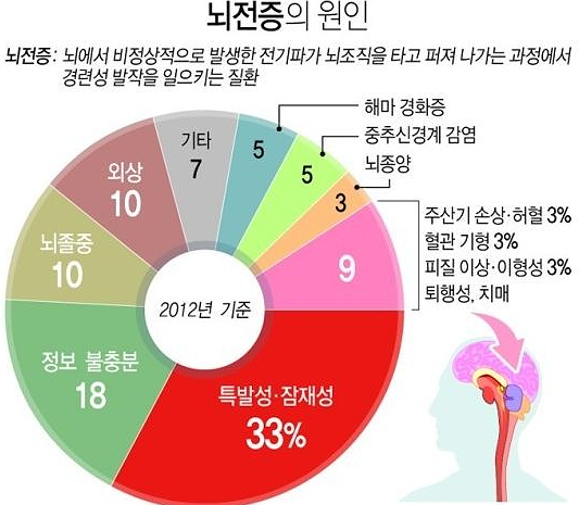 뇌전증 전조증상 완치