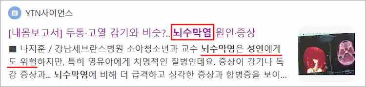 성인 뇌수막염 기사 이미지