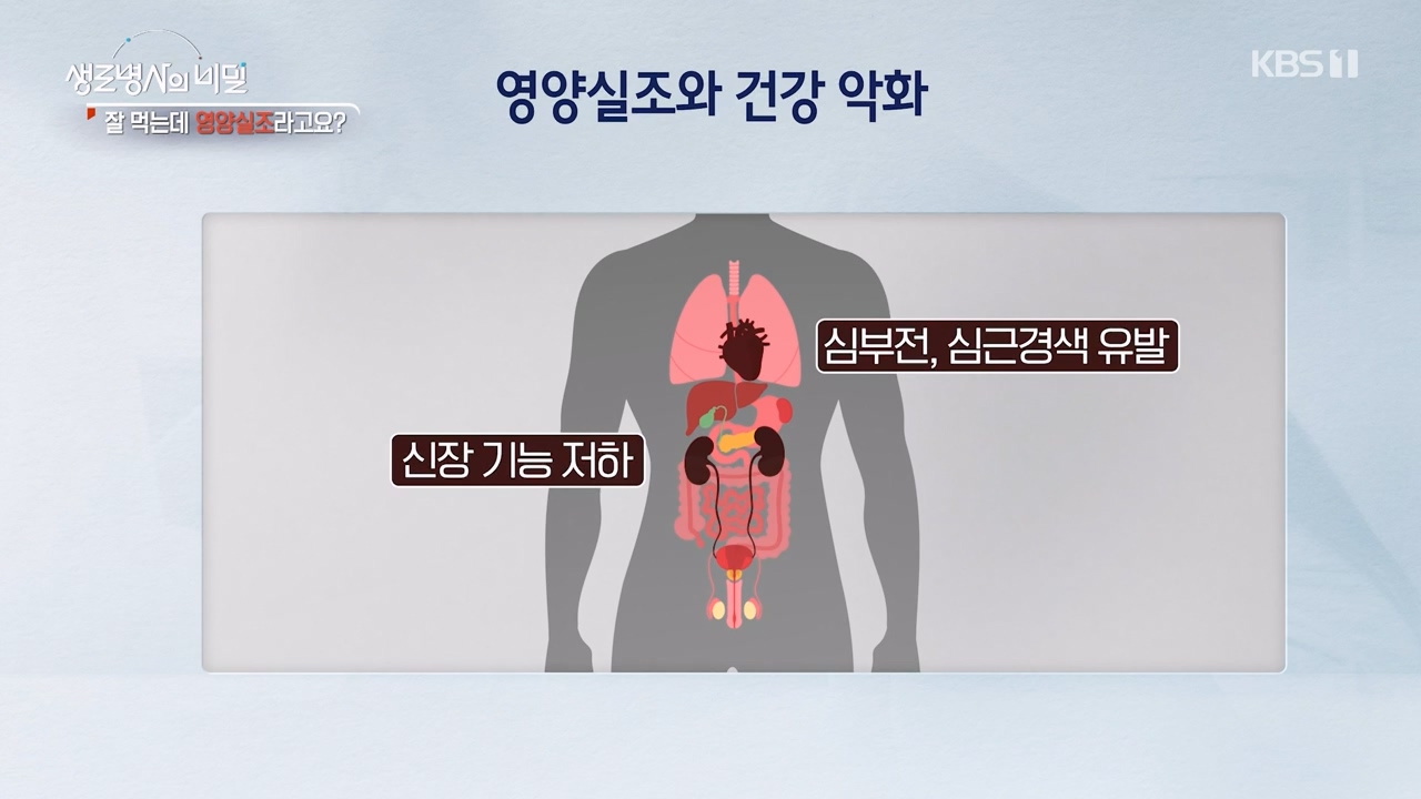생로병사의 비밀.E906.240328p-NEXT.mp4_20240328_210400.506.jpg