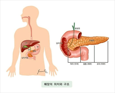 췌장암 초기증상 및 췌장암 예방법