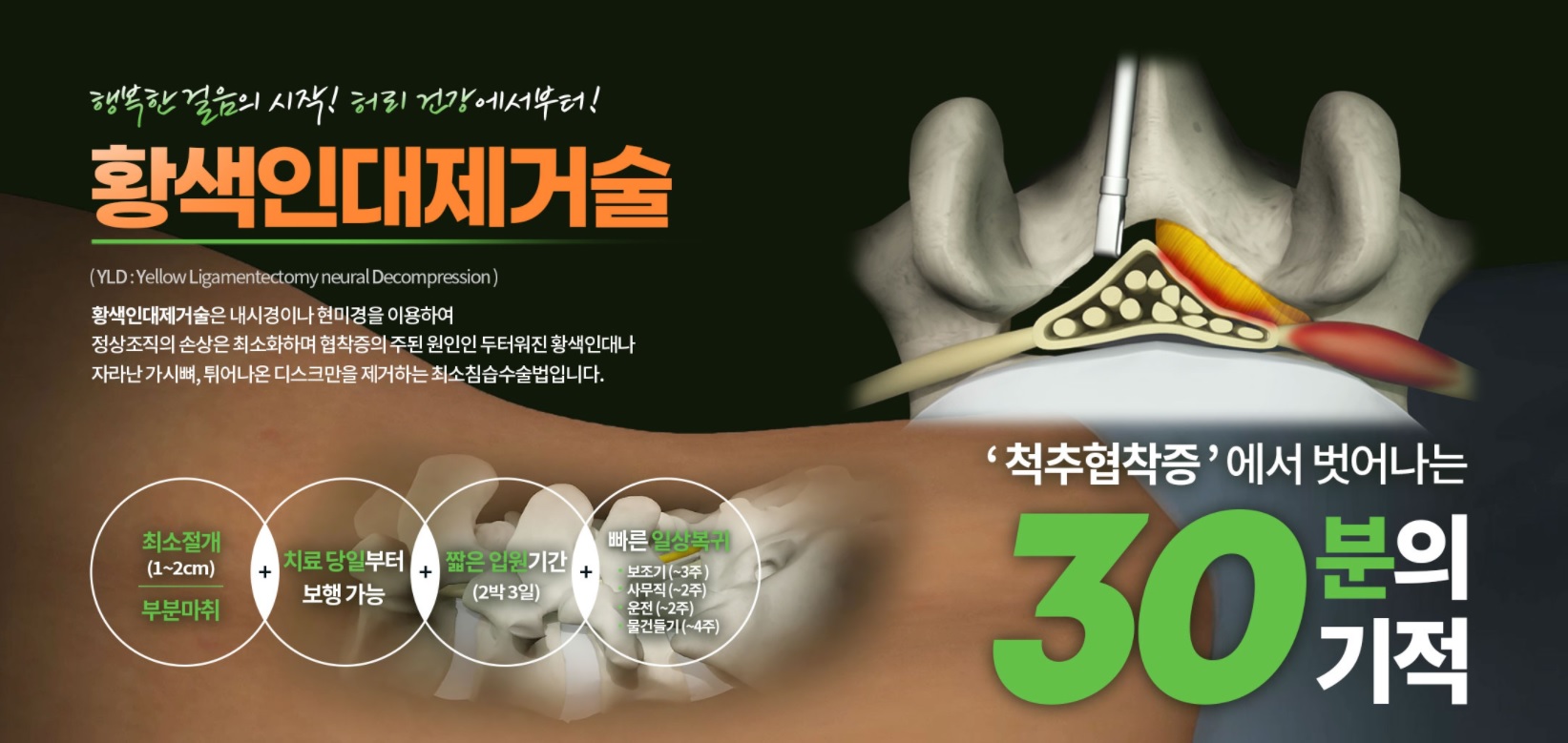  척추관협착증 치료방법, 수술 치료법이 꼭 해결책일까요?