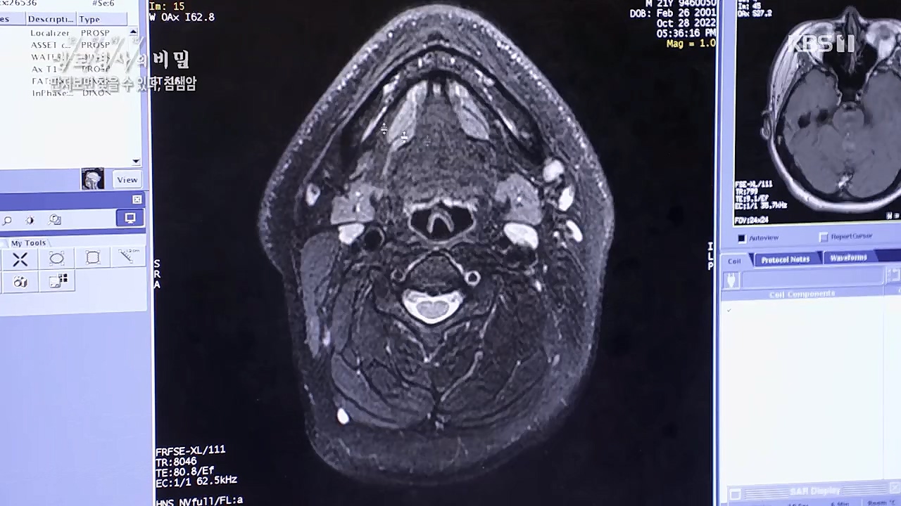 생로병사의 비밀.E851.230112p.H264-F1RST.mp4_20230119_200627.693.jpg