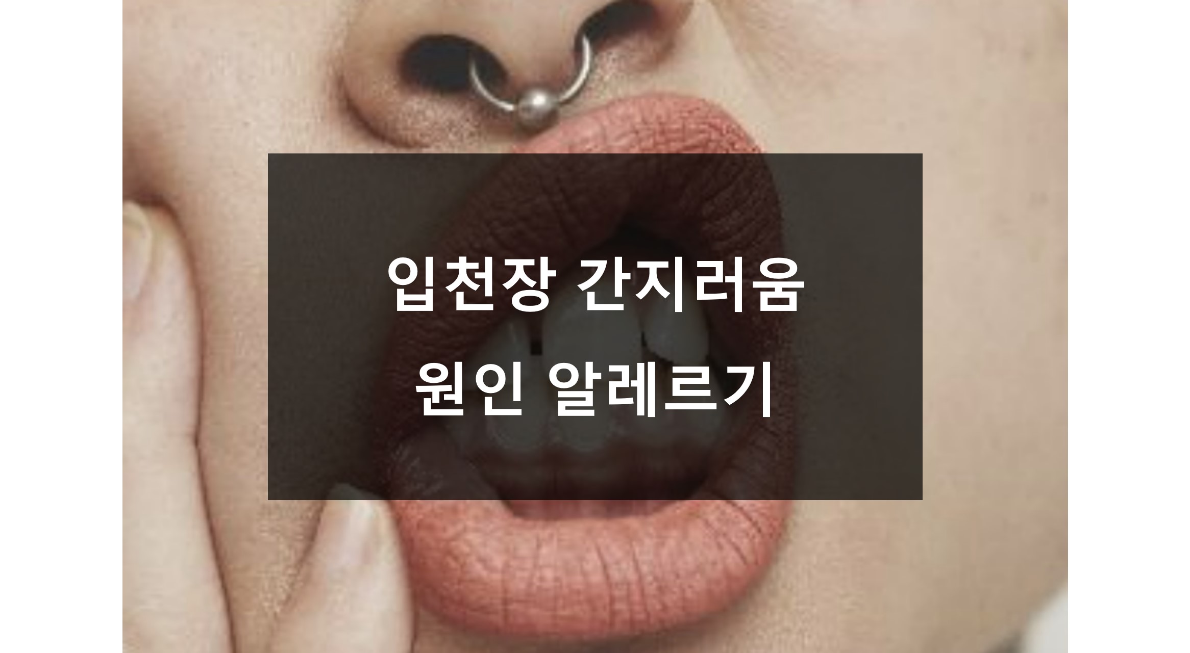 입천장 간지러움 알레르기