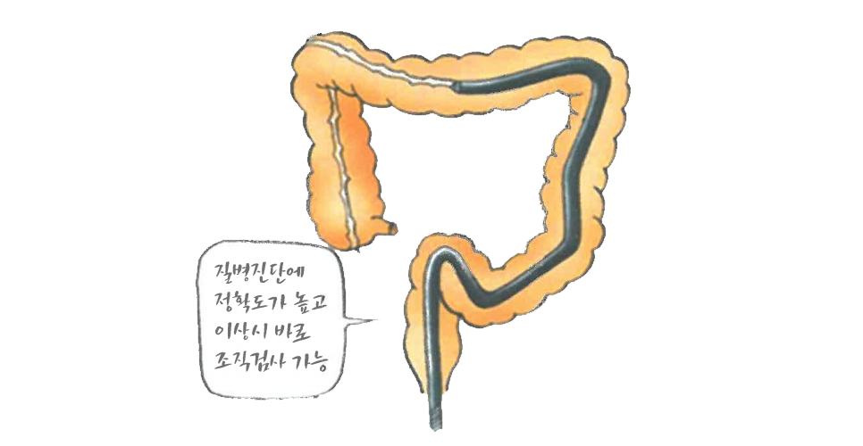  대장 건강을 지키는 첫걸음, 대장내시경 검사의 중요성