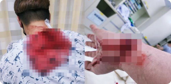  심야에 호수 산책하는 연인에 흉기 휘두른 30대 긴급 체포