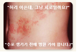 대상포진증상
대상포진 예방접종
대상포진초기증상
대상포진전염성
대상포진병원
대상포진 주사
대상포진 저염
단순 포진
허리대상포진
손대상포진