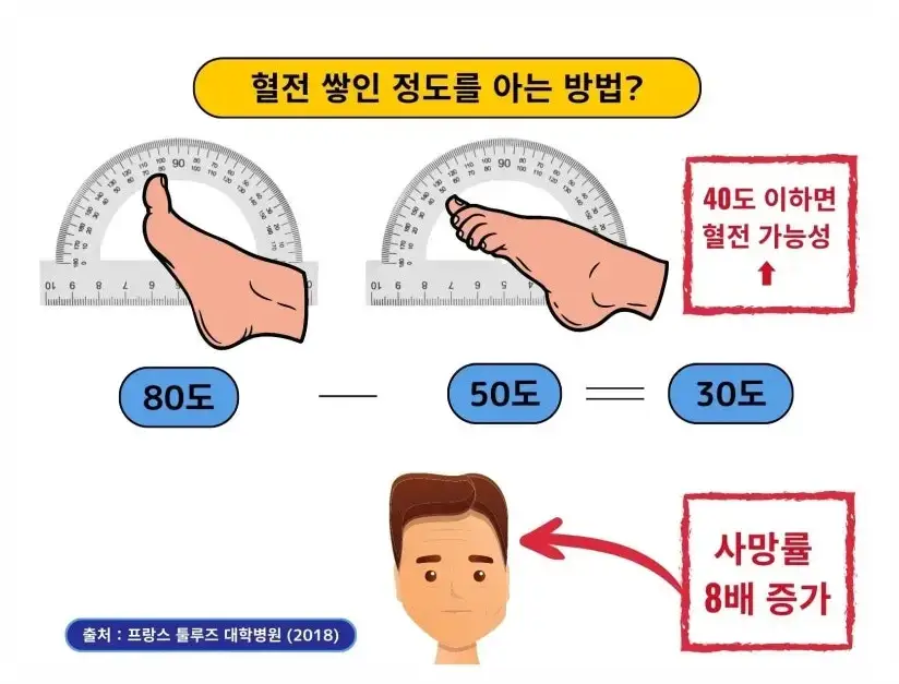 혈전용해제 나토키나제