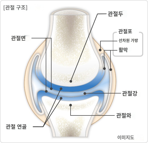  관절통 (변형성 관절증)에 대해 알아보자