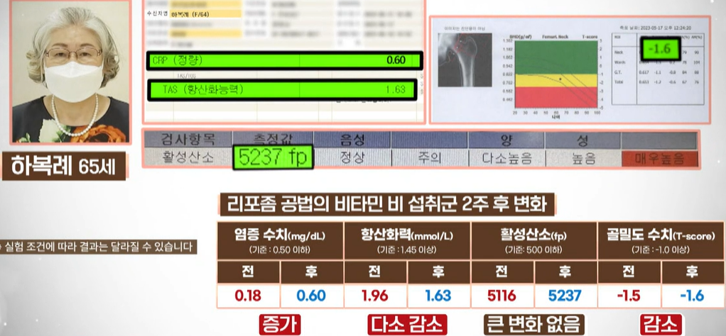 리포좀 비타민C 효능