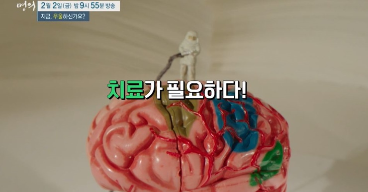 뇌-모형