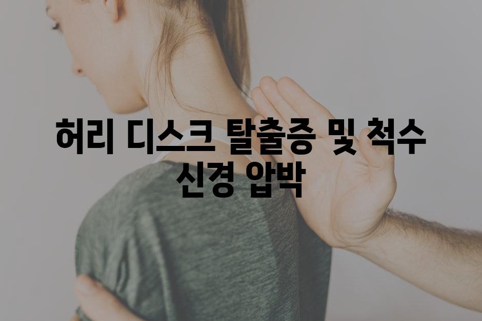 허리 디스크 탈출증 및 척수 신경 압박