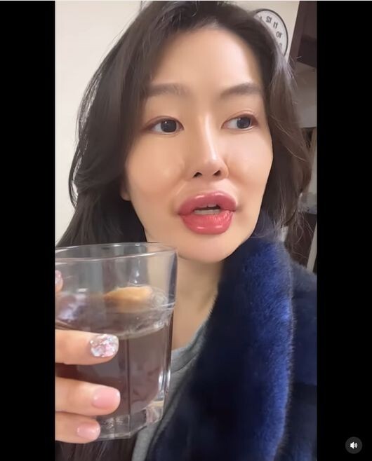  이용식 딸 이수민, 88kg→48kg 충격적 외모 근황 "입술은 무슨 일?"