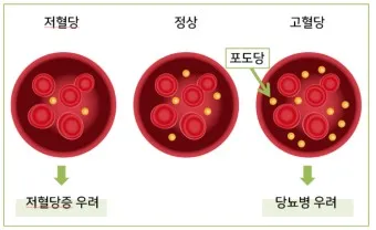 혈당 낮추는 방법 혈당관리식당 메뉴 식사법_11
