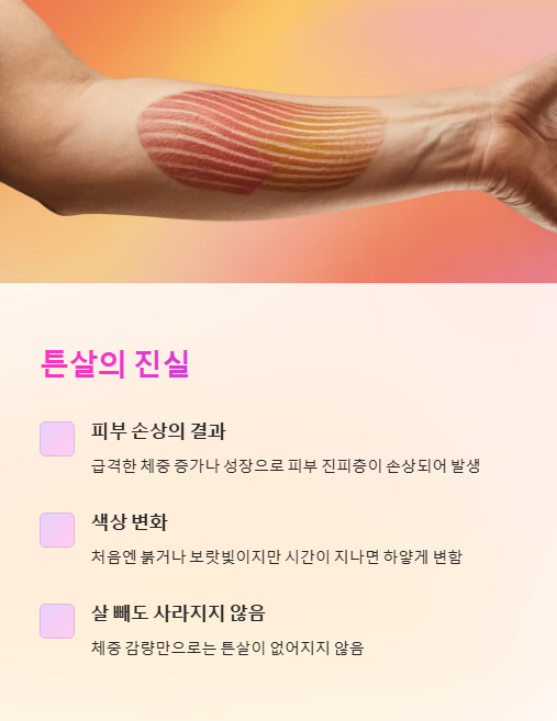 튼살의 진실