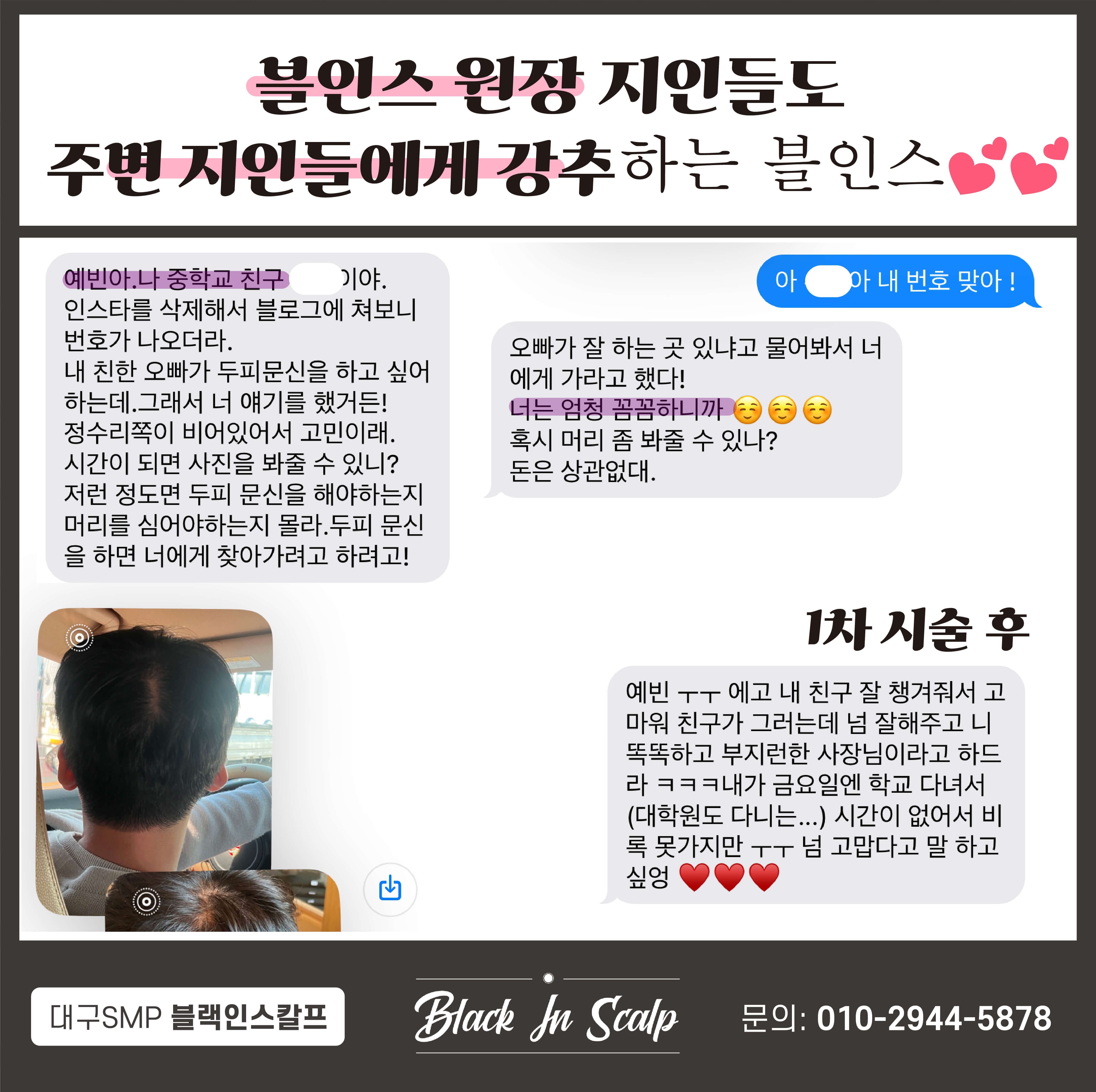 블랙인스칼프 이미지