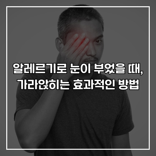 알레르기로 눈이 부었을 때, 가라앉히는 효과적인 방법