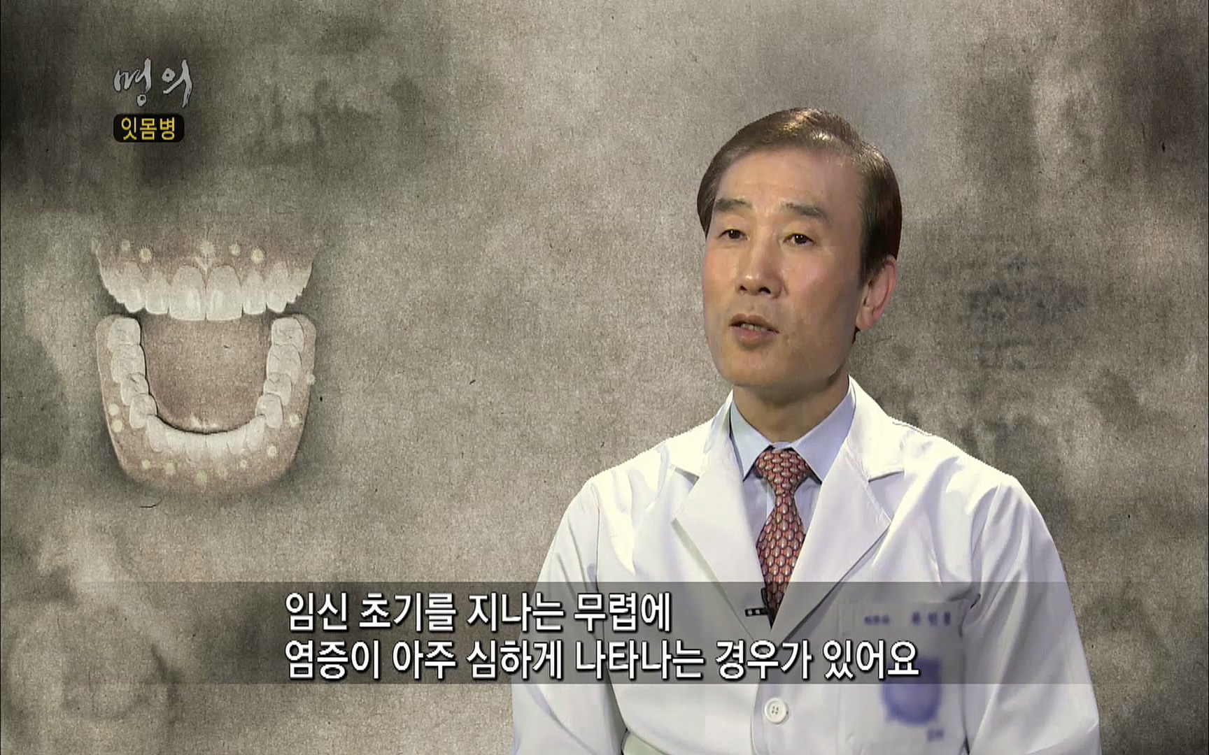 EBS 명의 헬스케어 - TV - 교육의 중심 EBS2015년 1월 16일 (금) 밤 9시 50분, EBS1.mp4_20220505_150413.649.jpg