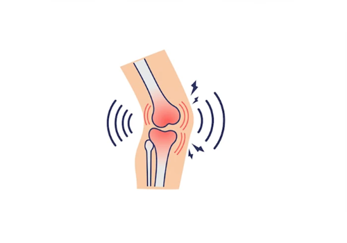 움직이는 관절 아이콘에서 소리나 마찰을 나타내는 아이콘이 퍼져나오는 미니멀 플랫 디자인 일러스트 관절 마찰음 크레피투스 시각화