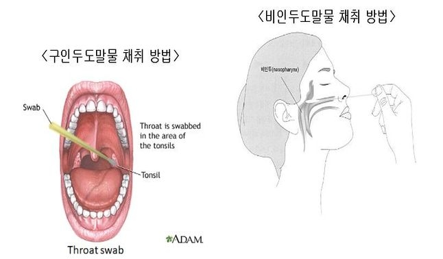 침키트(타액키트) 관련주