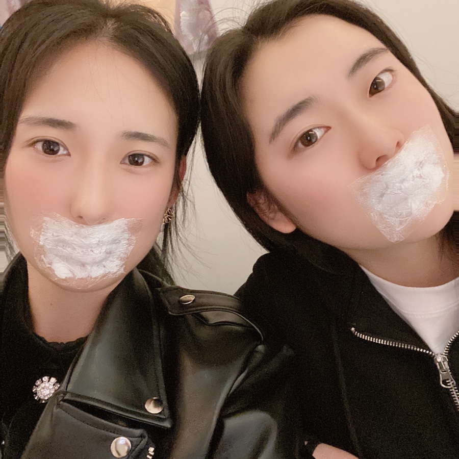 입술 보톡스 부작용 대전 입술필러+입꼬리보톡스 내돈내산