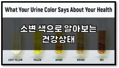  소변 색으로 알아보는 건강상태
