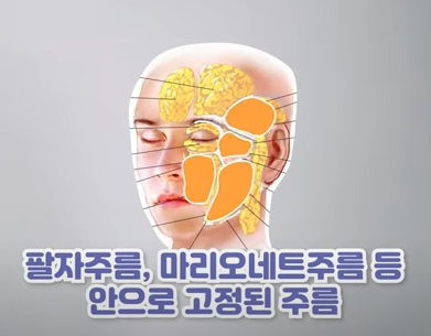  얼굴 주름이 생기는 이유와 치료 방법