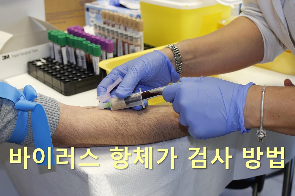 바이러스 항체가 검사 방법