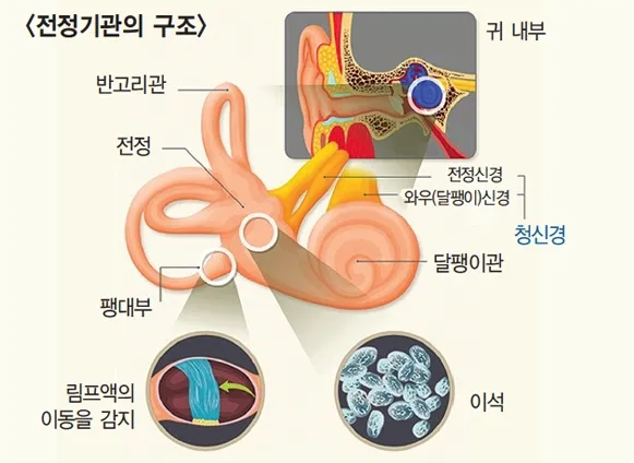 이석증 증상과 자가치료법