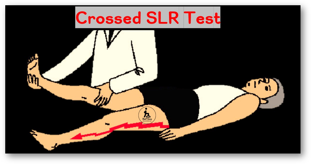 Crossed SLR test