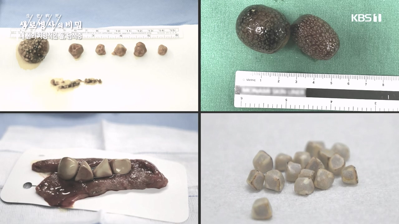 생로병사의 비밀.E886.231019p-NEXT.mp4_20231019_203453.592.jpg