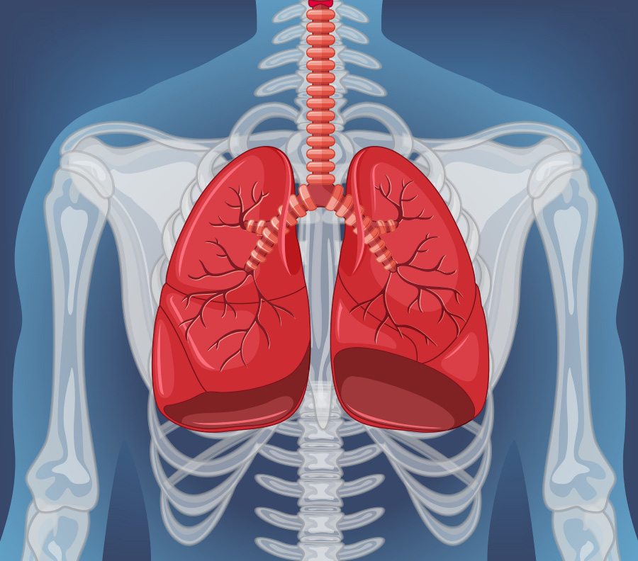 인체의 폐를 X-ray처럼 상체의 뼈가 보이는 바탕 위에 폐의 위치와 형태를 빨갛게 표시를 해 놓은 이미지 사진
