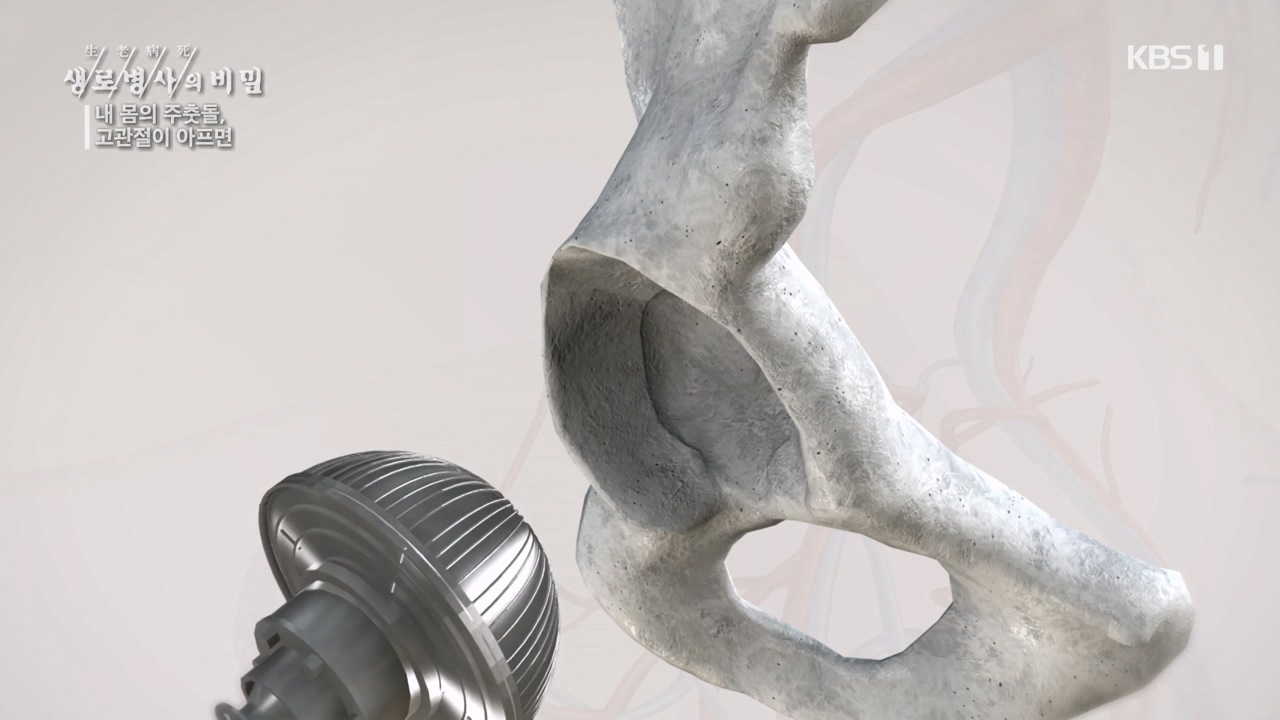 생로병사의 비밀.E890.231116p-NEXT.mp4_20231116_204850.212.jpg
