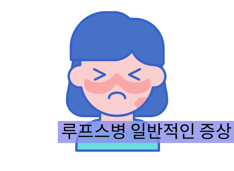 루프스병 일반적인 증상