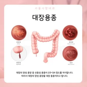 대장내시경 용종제거 후 식사 식단조절_18