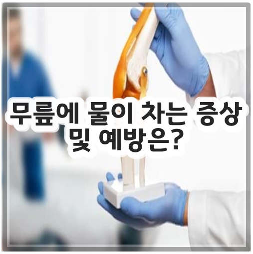 무릎에 물이 차는 증상 및 예방은?