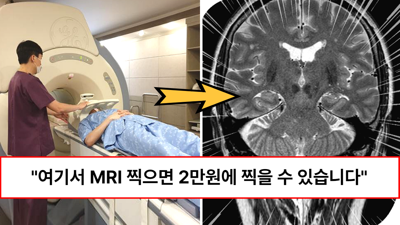 “이것 모르고 찍으면 호구됩니다” 365일 언제나 비싼 MRI 호갱 소리 안 듣고 60% 싸게 찍는 꿀팁 (feat. 4가지)