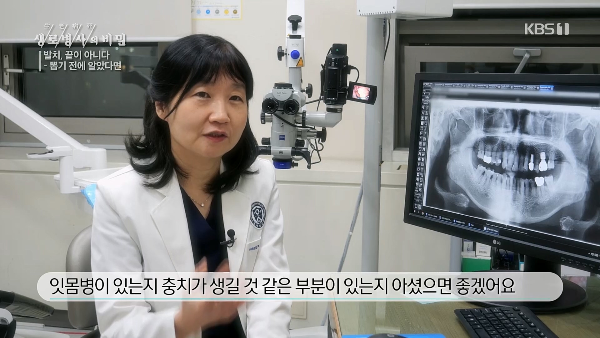 생로병사의 비밀.E855.230208p.H264-F1RST.mp4_20230214_194930.852.jpg