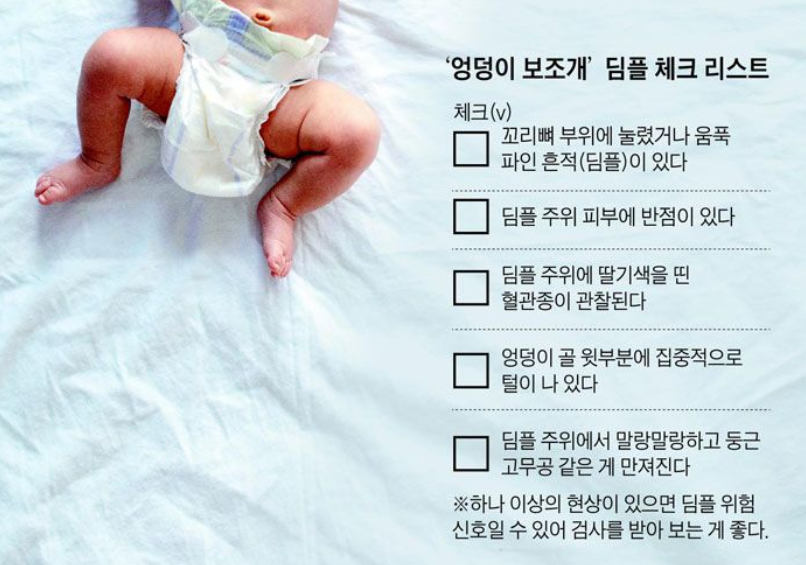 엉덩이딤플