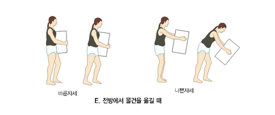 허리디스크 증세