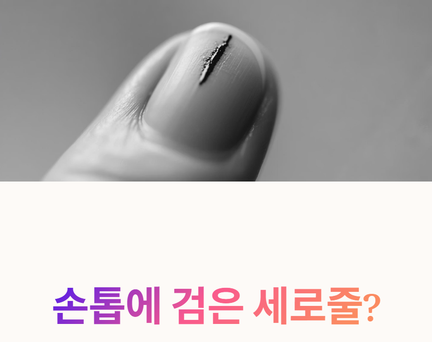 손톱에 검은 세로줄