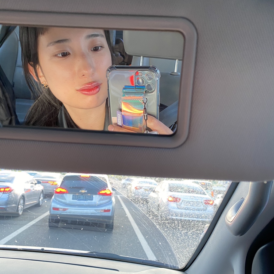 입술 보톡스 부작용 대전 입술필러+입꼬리보톡스 내돈내산 13