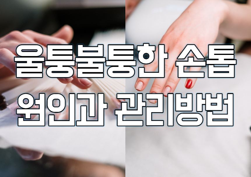  손톱 울퉁불퉁 원인과 관리방법
