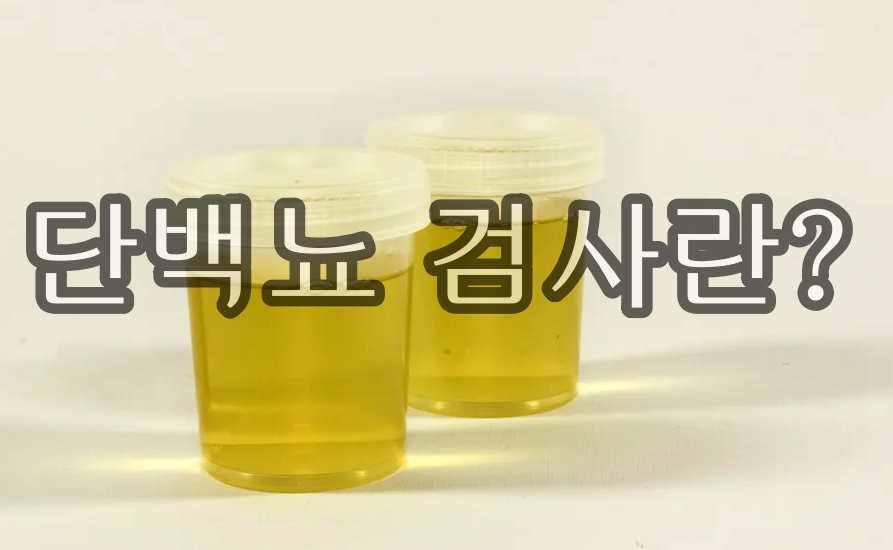 소변컵