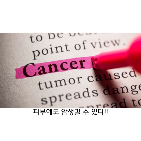  피부암 원인과 증상 후유증, 치료방법에 대해서